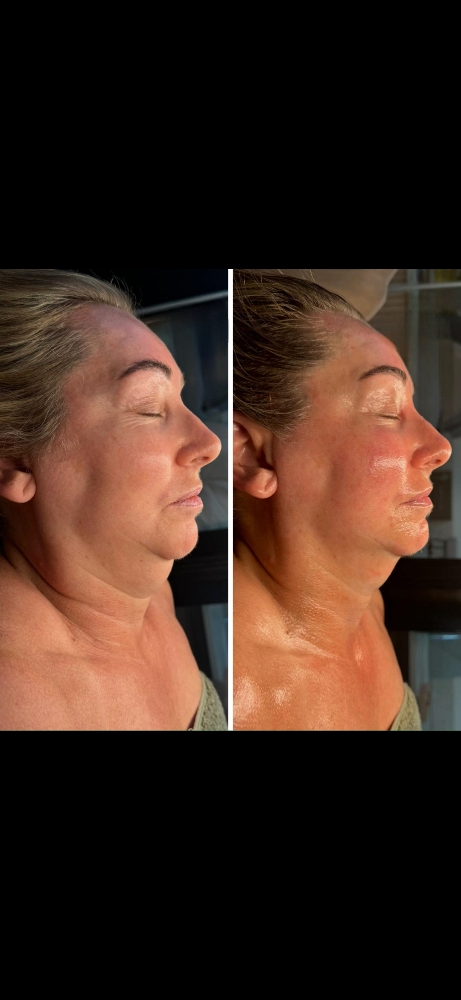 Add on - Lymphatic Drainage Trio