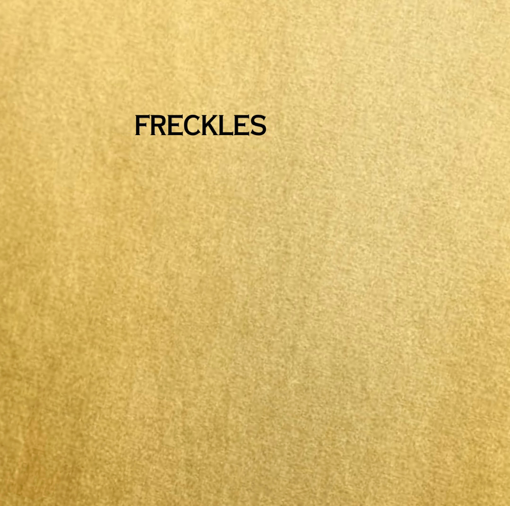 Freckles