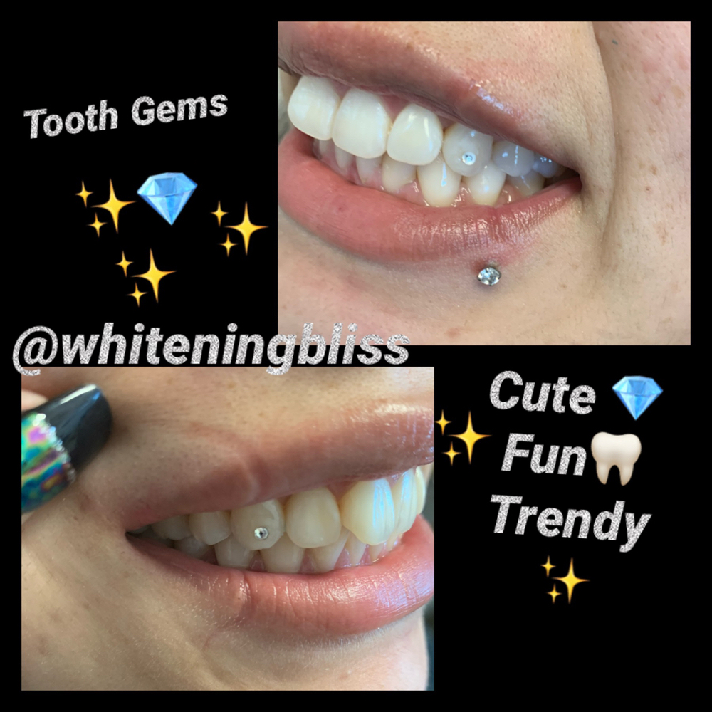 Single Tooth Gem✨🦷💎✨ at Whitening Bliss✨🦷✨ in San Jose, CA