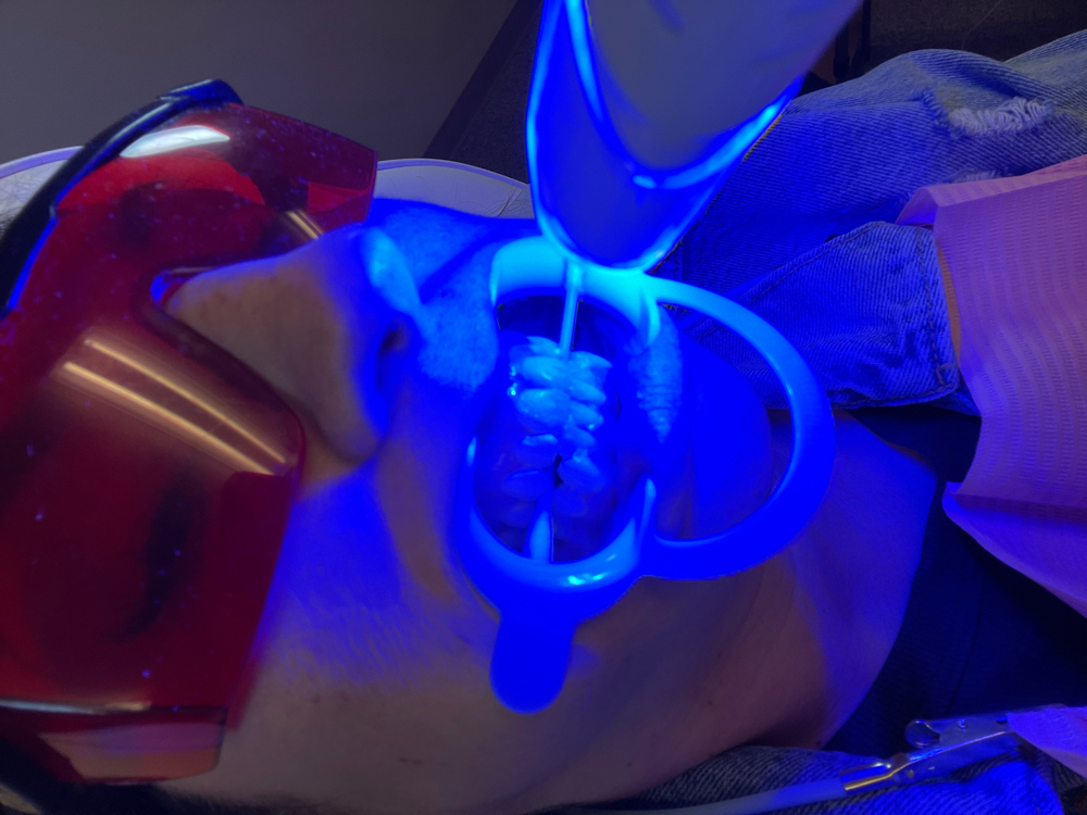 Teeth Whitening / Gem State Glow