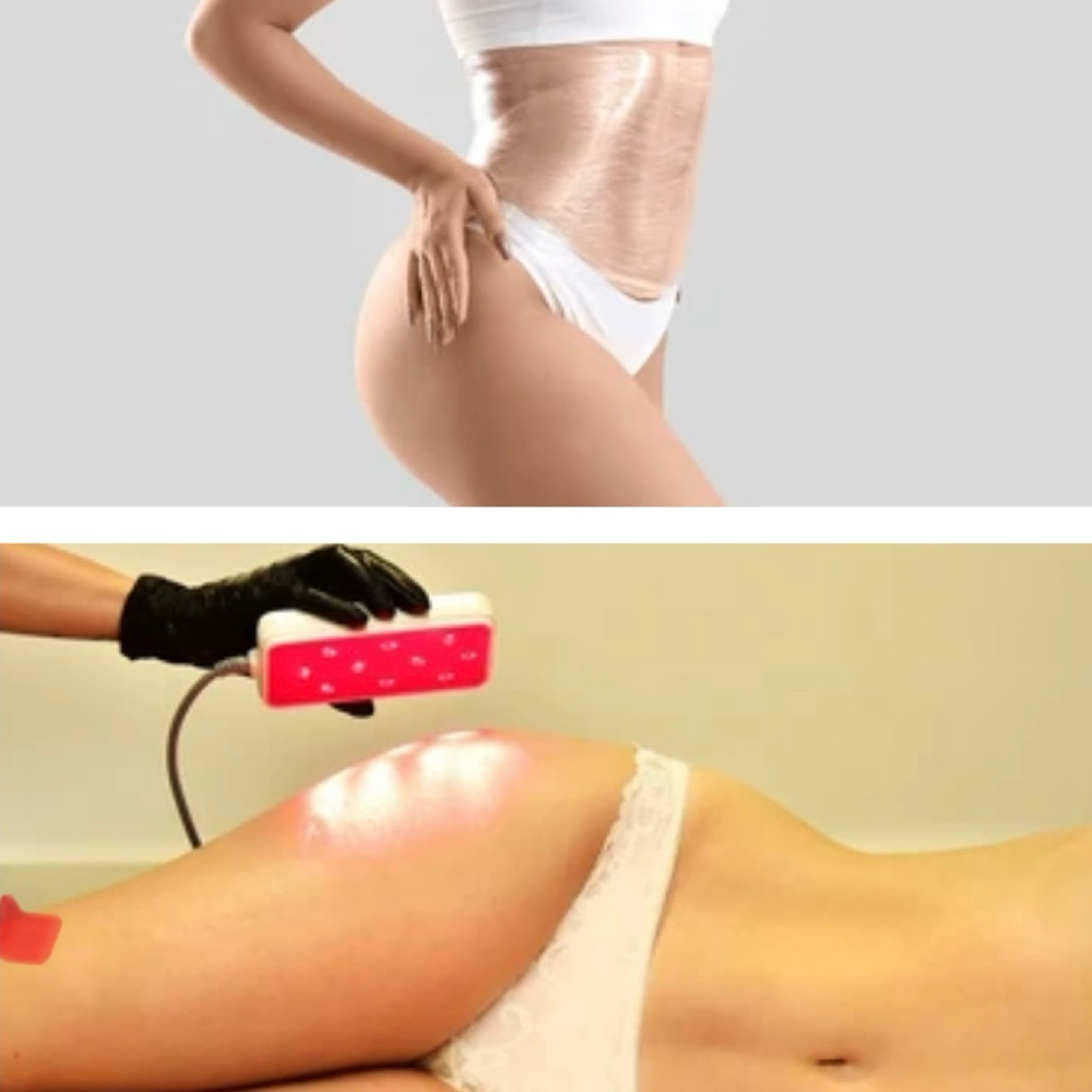 Red Light Therapy & Body Wrap