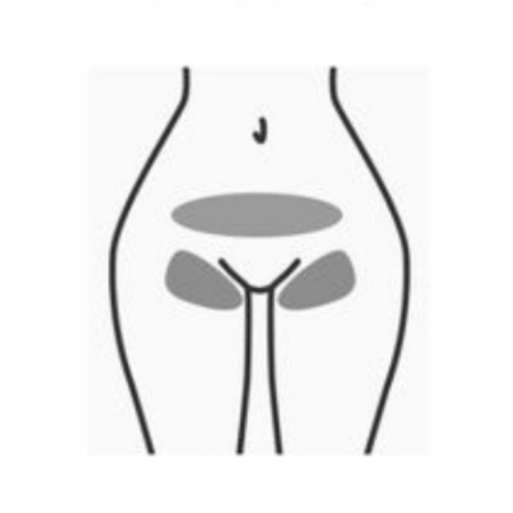 Bikini at CareBeautyDerm in Smithtown, NY