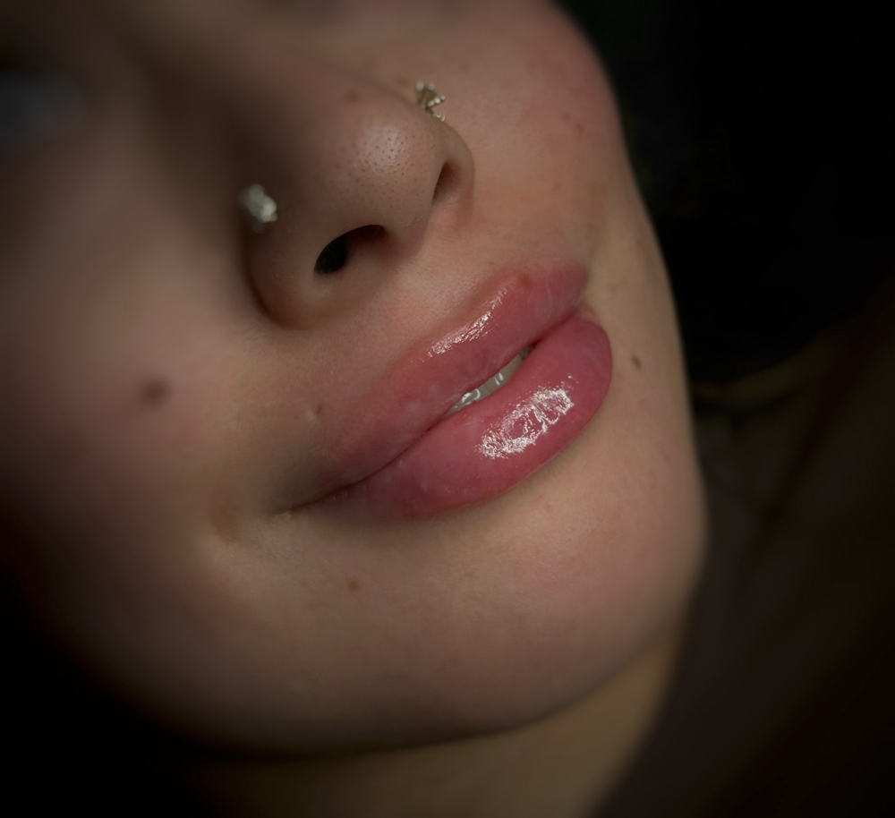 Quick Plump at Beauty by Cecily in Sparks, NV