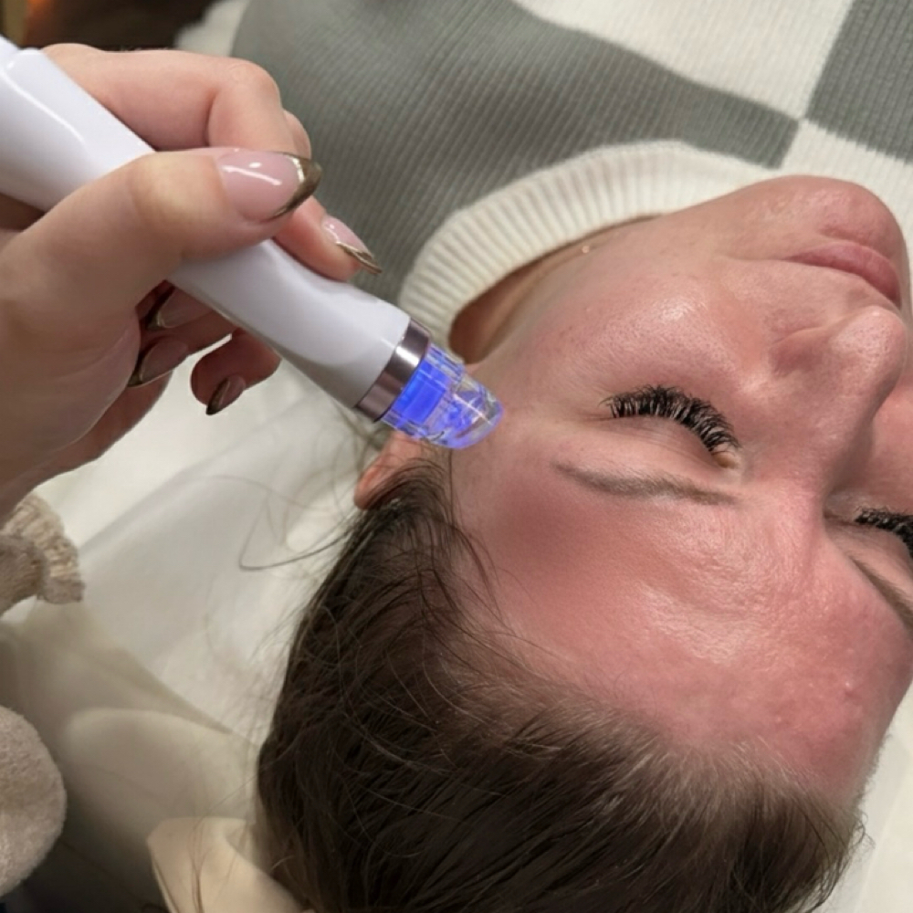Diamond Deluxe Hydro-facial at Pure Elegance Esthetics in North Andover, MA
