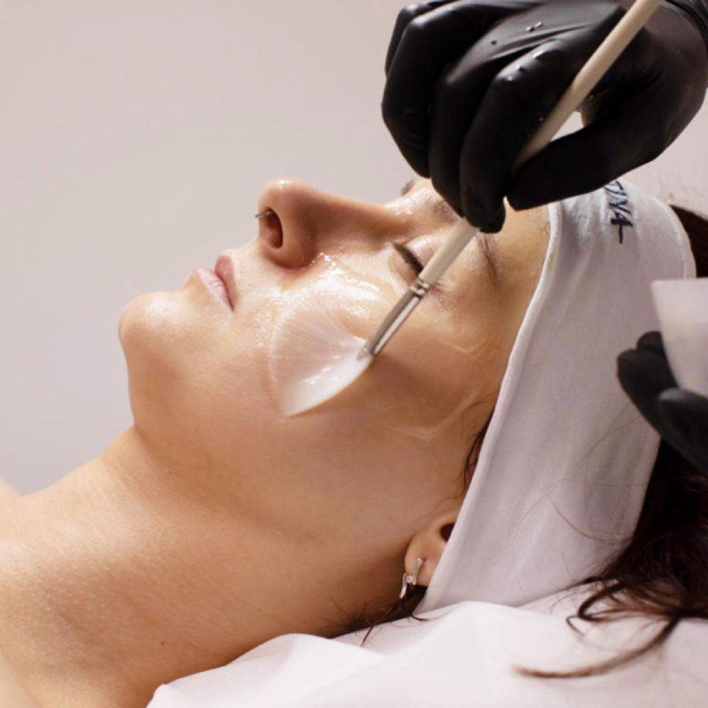 Chemical Peel at Beauty By Keri in Franklin, MA