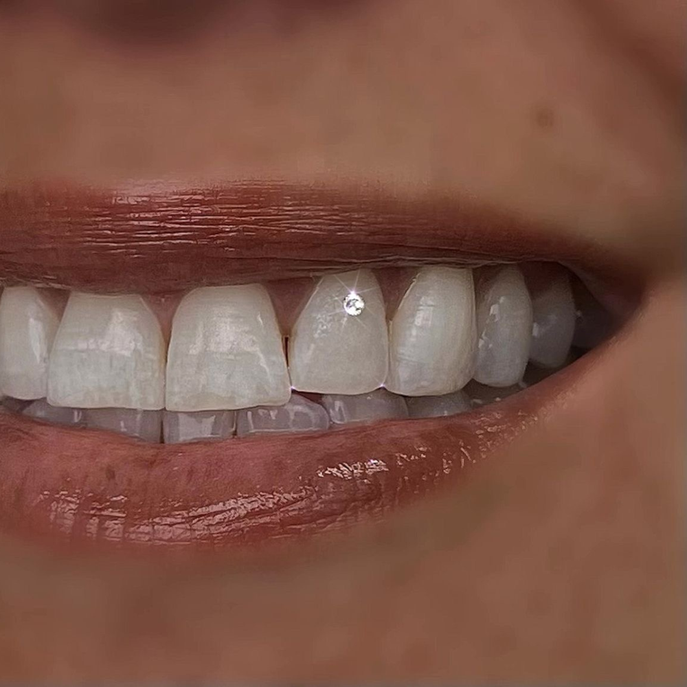 Single Tooth Gem