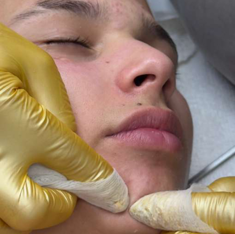 Teen Facial ( 12 to 17 Y/O) at Transformed Beauty in Leomister, MA