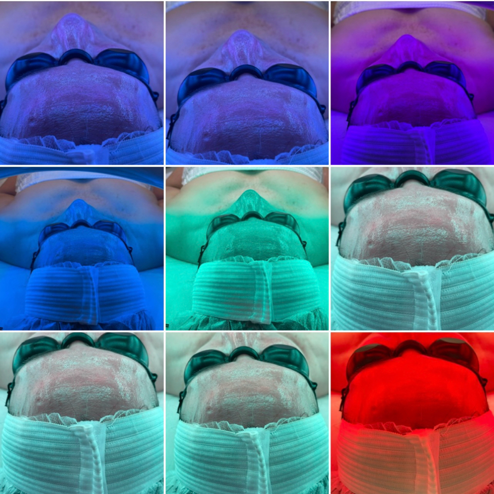 LED Light Therapy ADD-ON