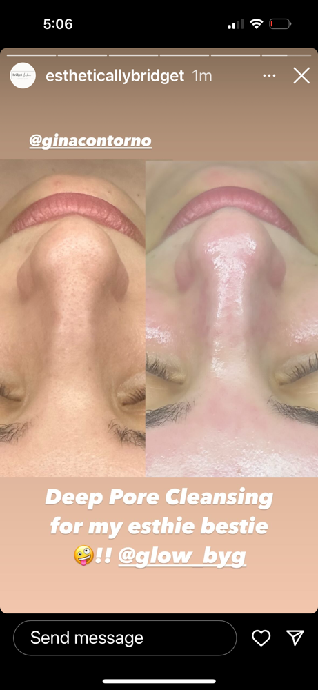 Deep Pore Cleansing Facial at Bridge2Beauty in Wantagh, NY