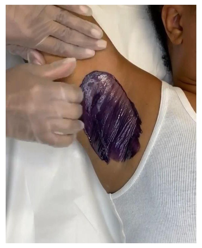Under Arm Waxing