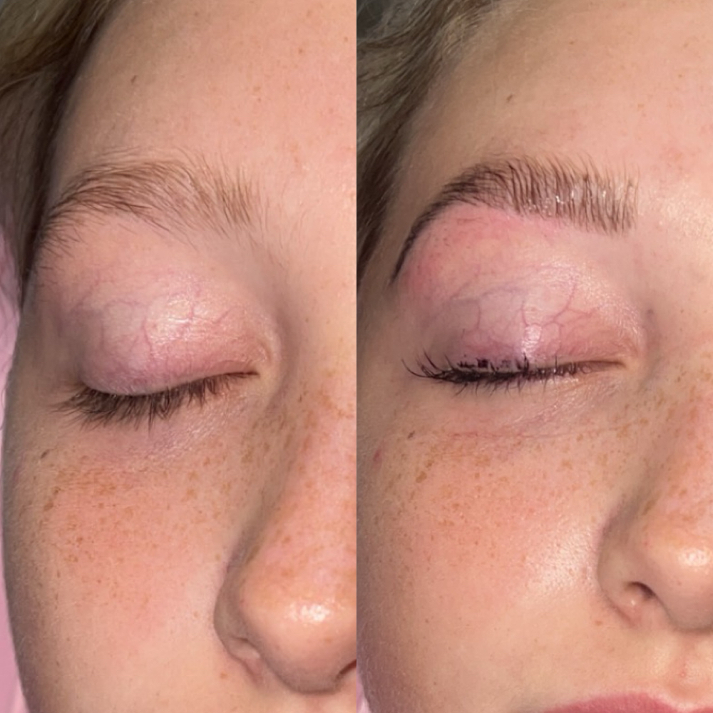 Brow Lamination