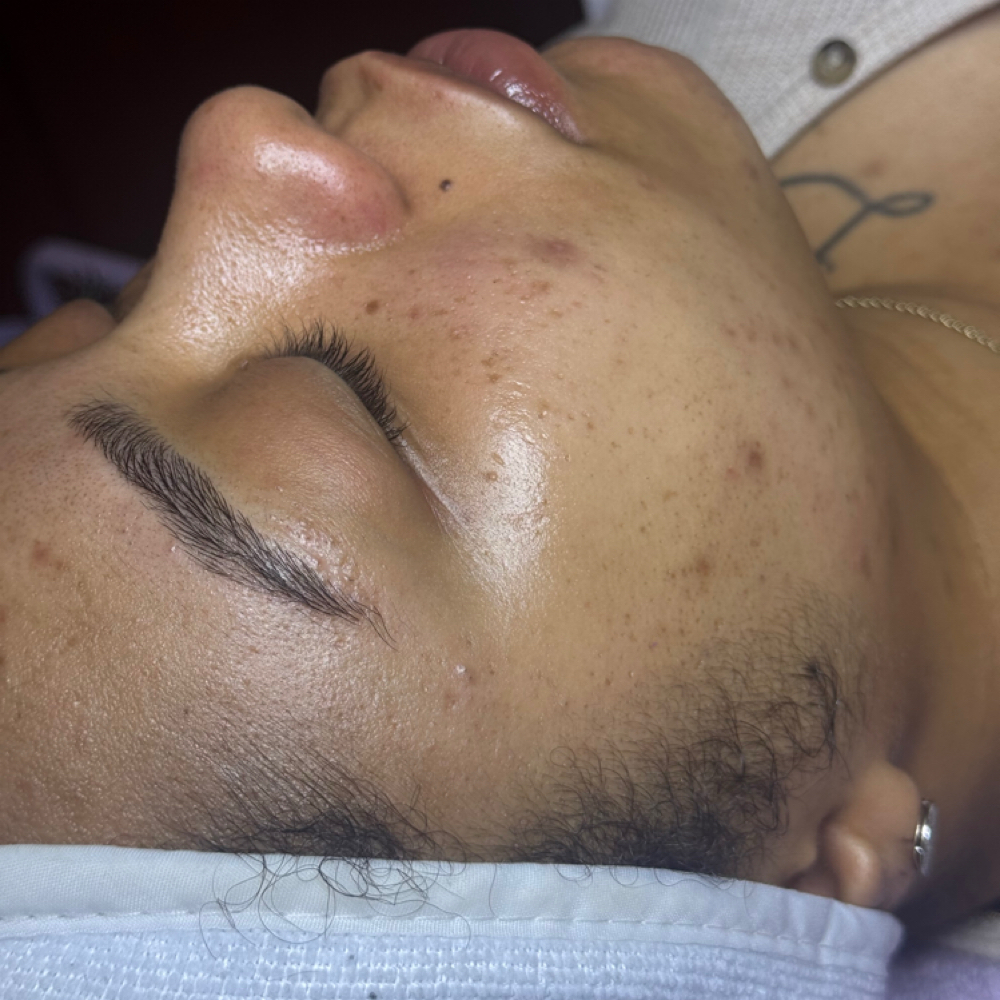Signature Facial at Danae Esthetics in Center Line, MI
