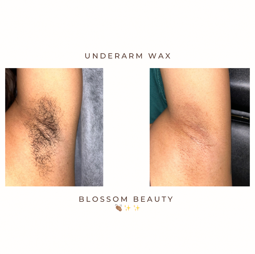 Underarms & Arms at Blossom Beauty in Clarksville, TN