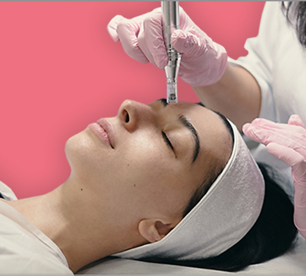 BOTOrX Nano Facial (no Needles)