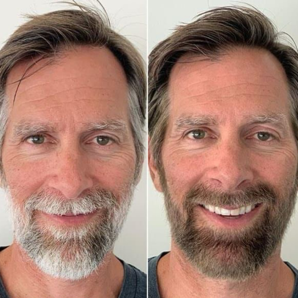 Beard/Hair Color Combo⭐️ at Blendz By Edith in Garland, TX