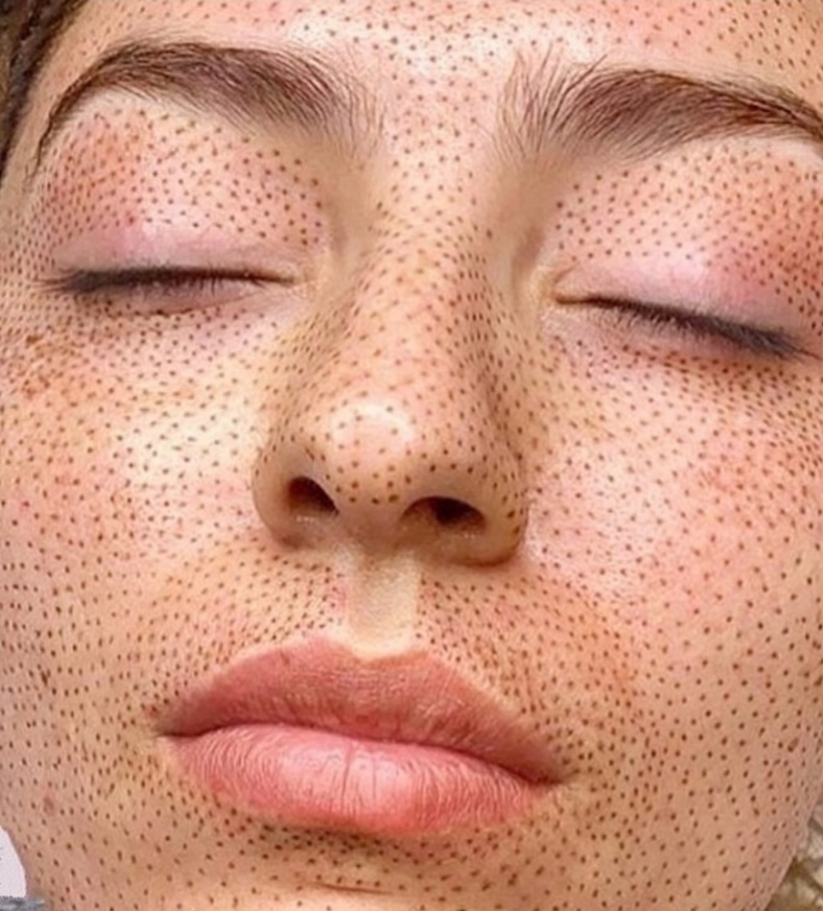 Plasma - full face