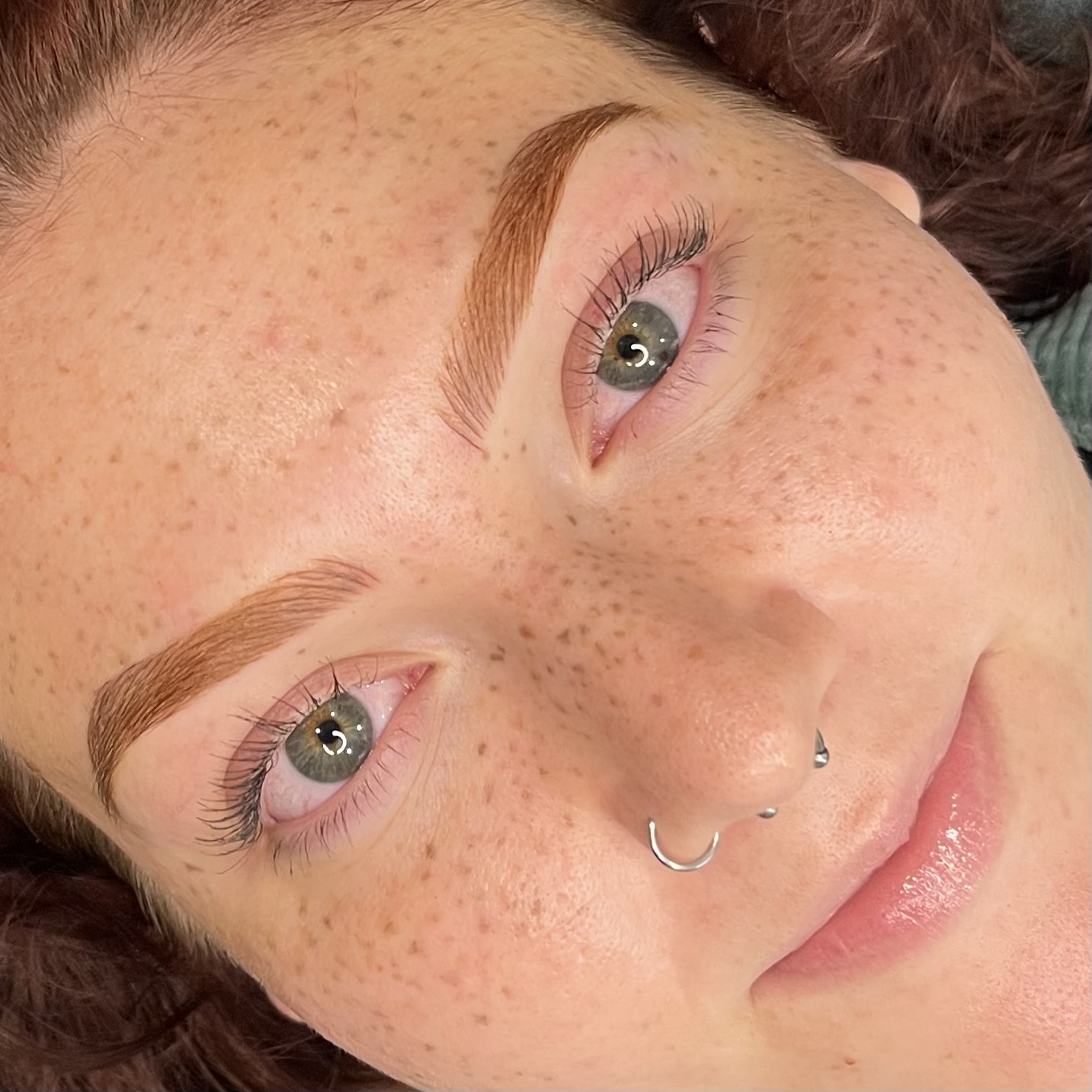 The Freckle