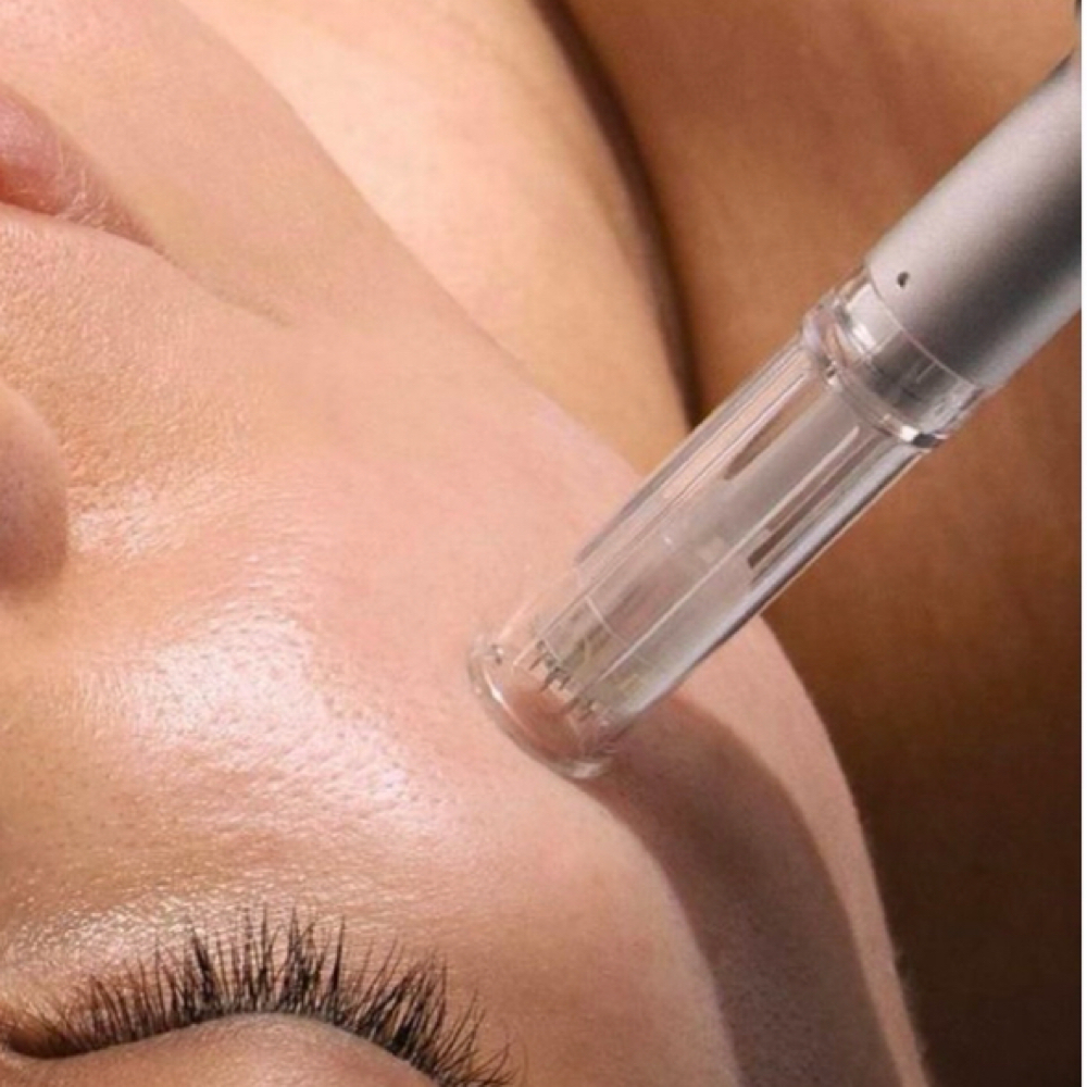 💉Microneedling Facial 💉 at Hidden Beauty Wax & Spa in Arlington, TX