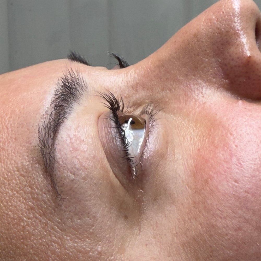 Lash Lift at Liv Beautiful Esthetics in CA, CA