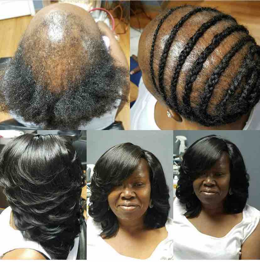 Sew In For Thinning /balding