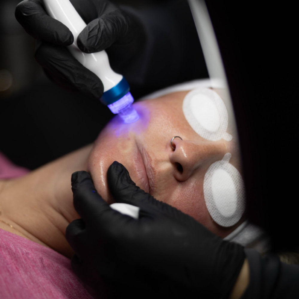 Mothers Day Hydrofacial + ONE at Aglow by LA Esthetics Ashley Rutter in Glenpool, OK