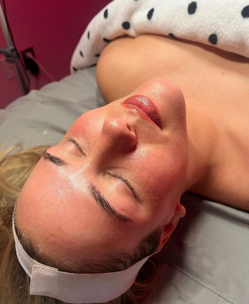 Dermaplane Facial