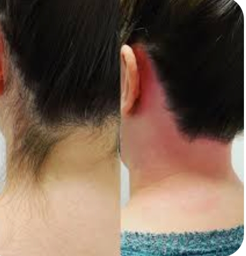 Neck Wax