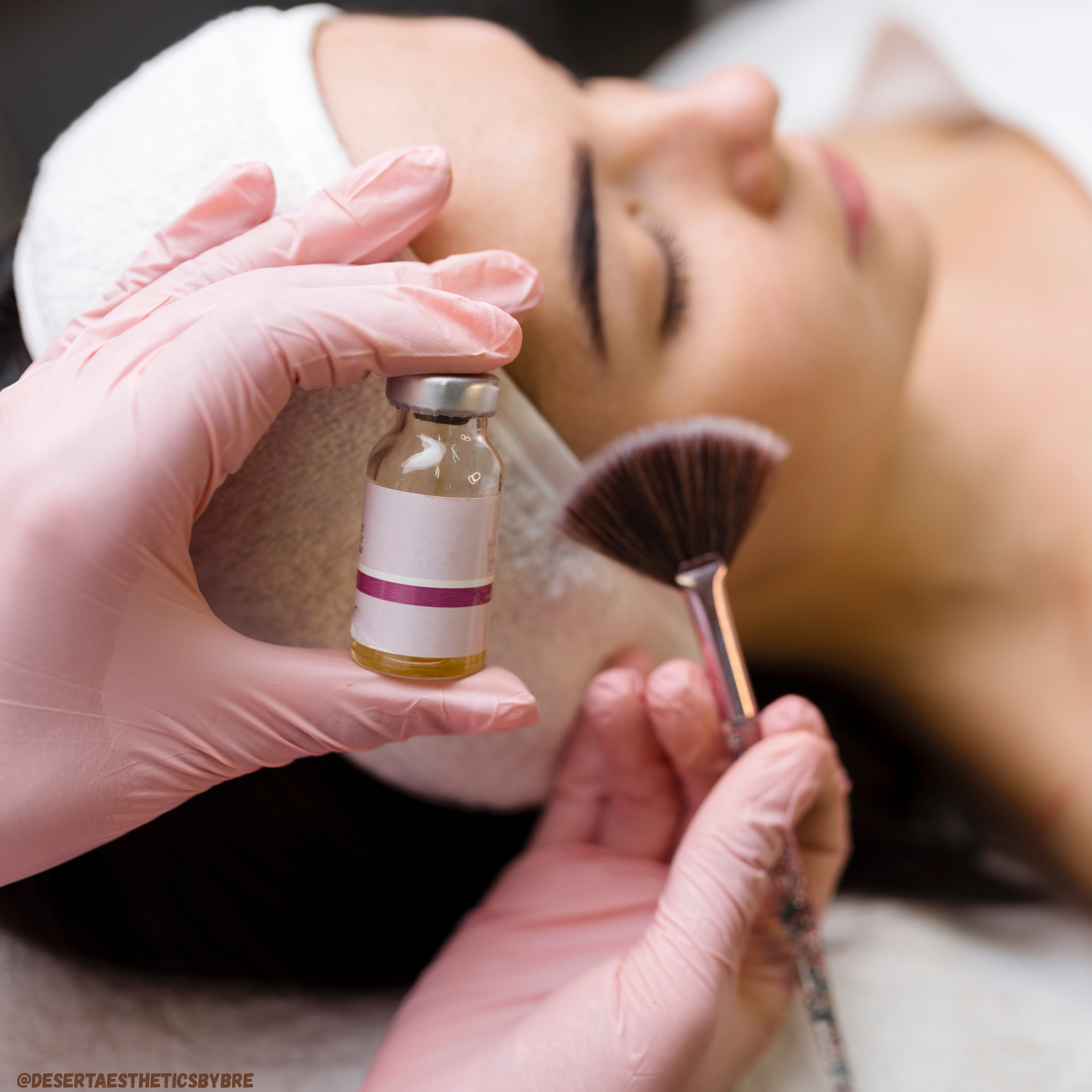 Chemical Peel at Desert Aesthetics By Bre in Gilbert, AZ