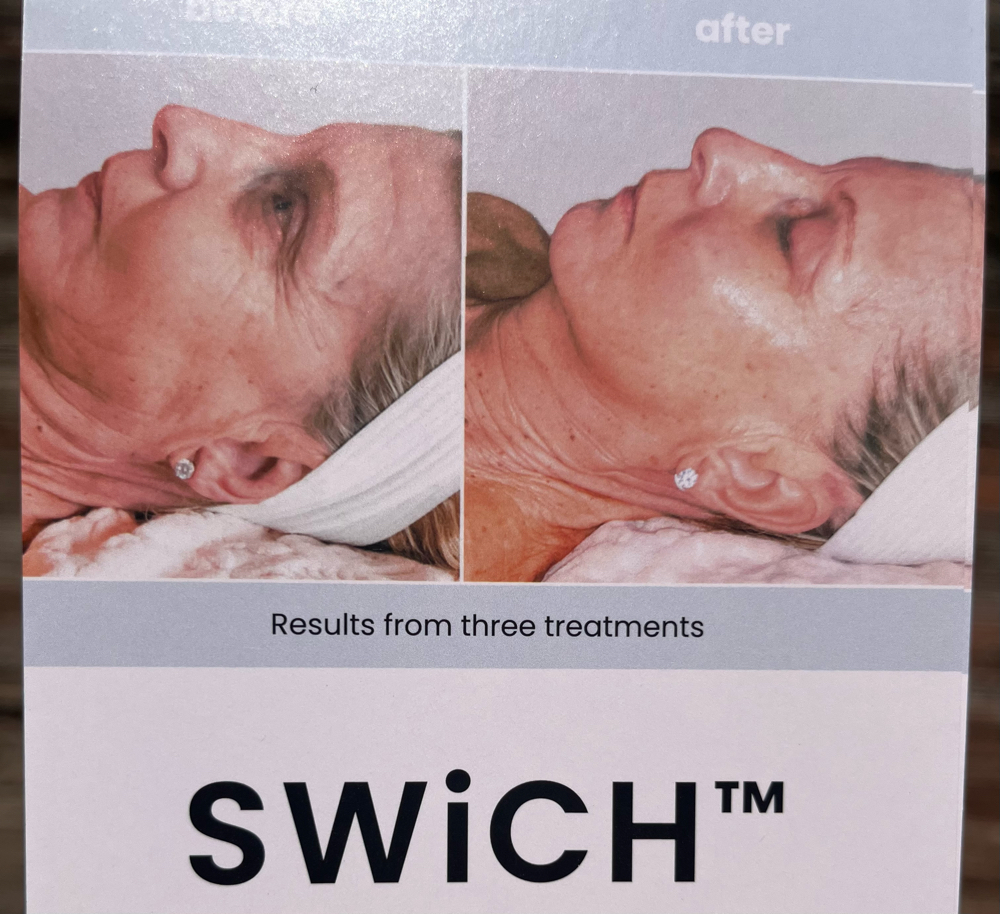 SWICH-package Of 6 Treatments