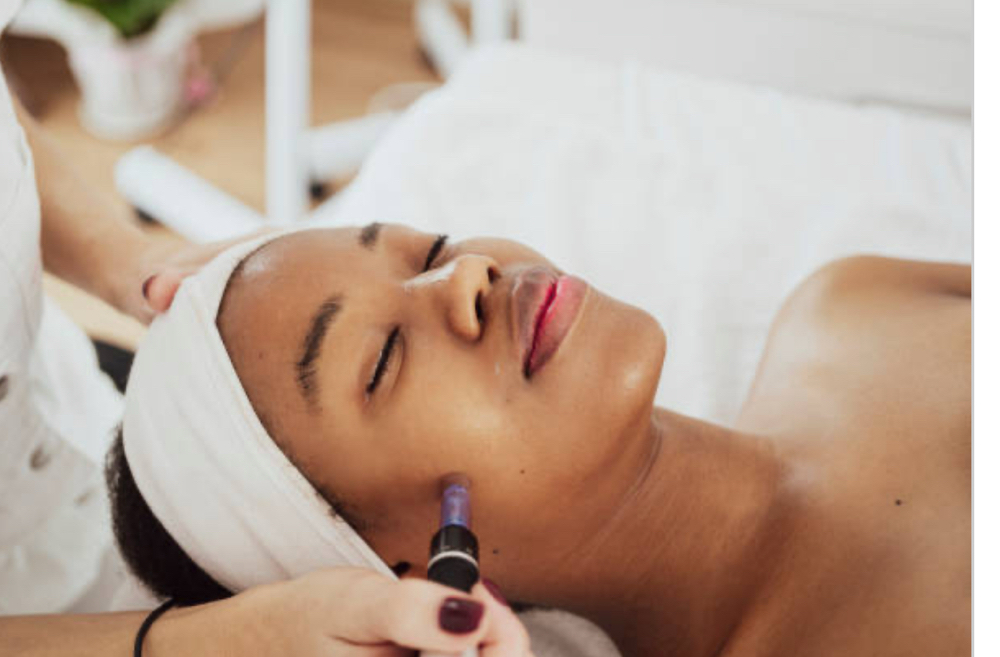 Package Microneedling 2 areas-3