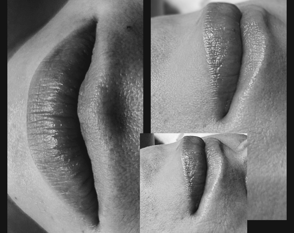 Lip Treatment at Hermosa Esthetics LLC. in Delta, CO