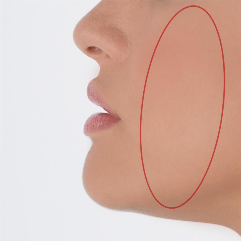 Cheek at Bareline Aesthetics in Brea, CA