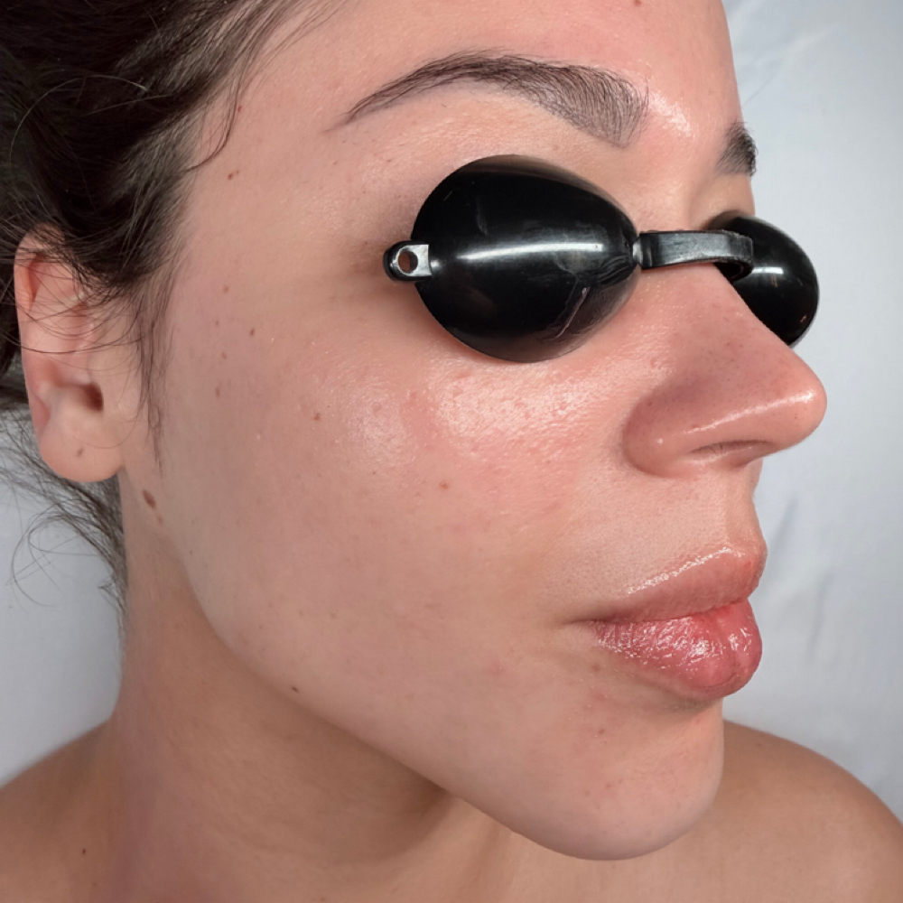 Enzyme Facial at Lumis MedSpa in Houston, TX