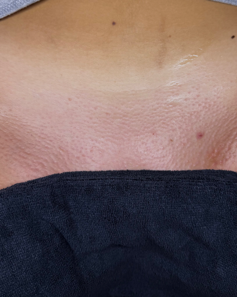 Brazilian Wax