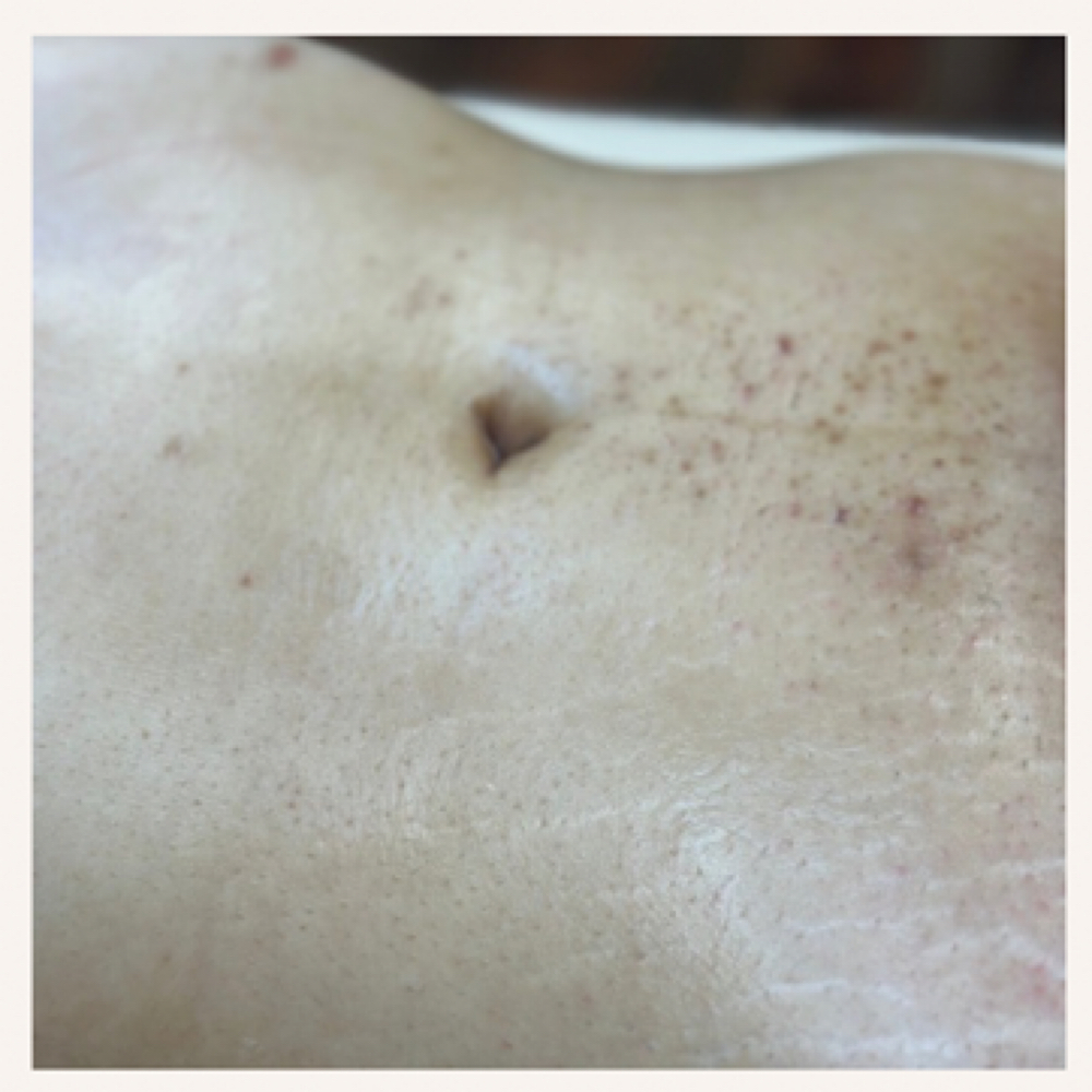 Full Stomach at Hidden Beauty Wax & Spa in Arlington, TX