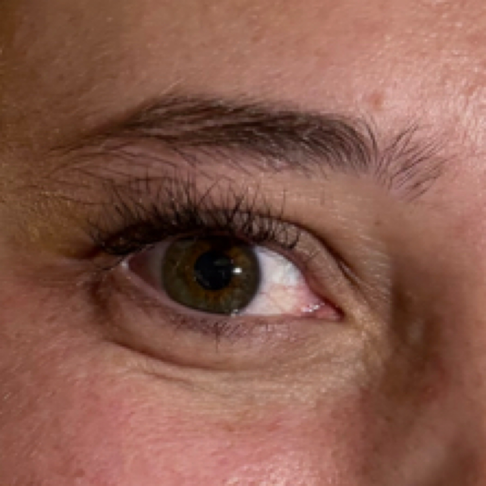 Classic 2wk Fill at Honey Whim Esthetics in Salt Lake City, UT