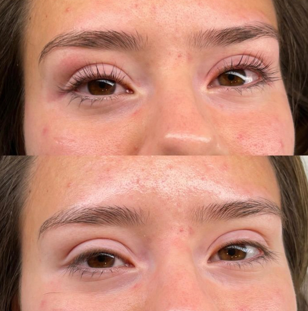Lash Lift