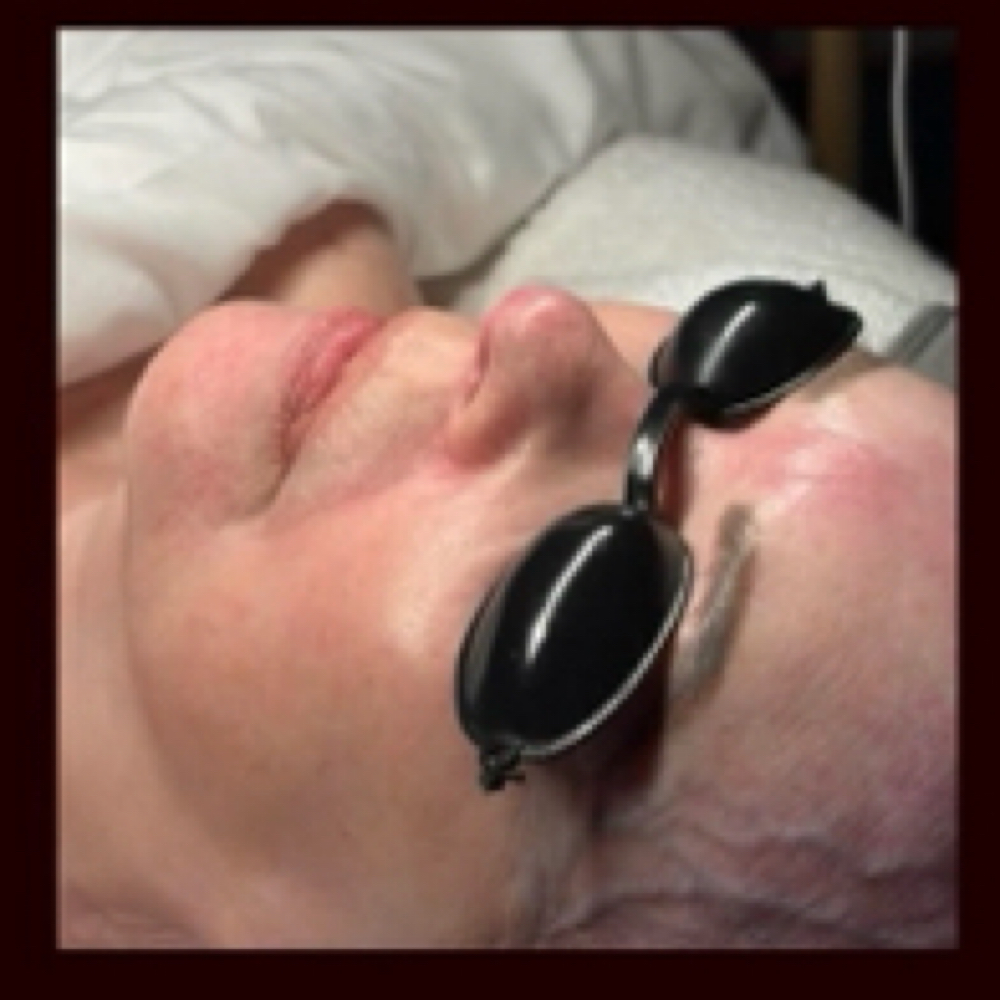 Skin Care Analysis at Amy Gudger, Licensed Esthetician in Kelseyville, CA