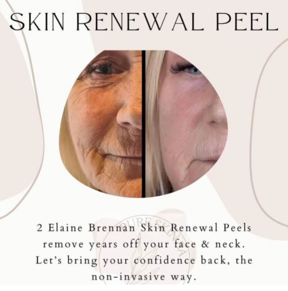 EB Skin Renewal Consultation