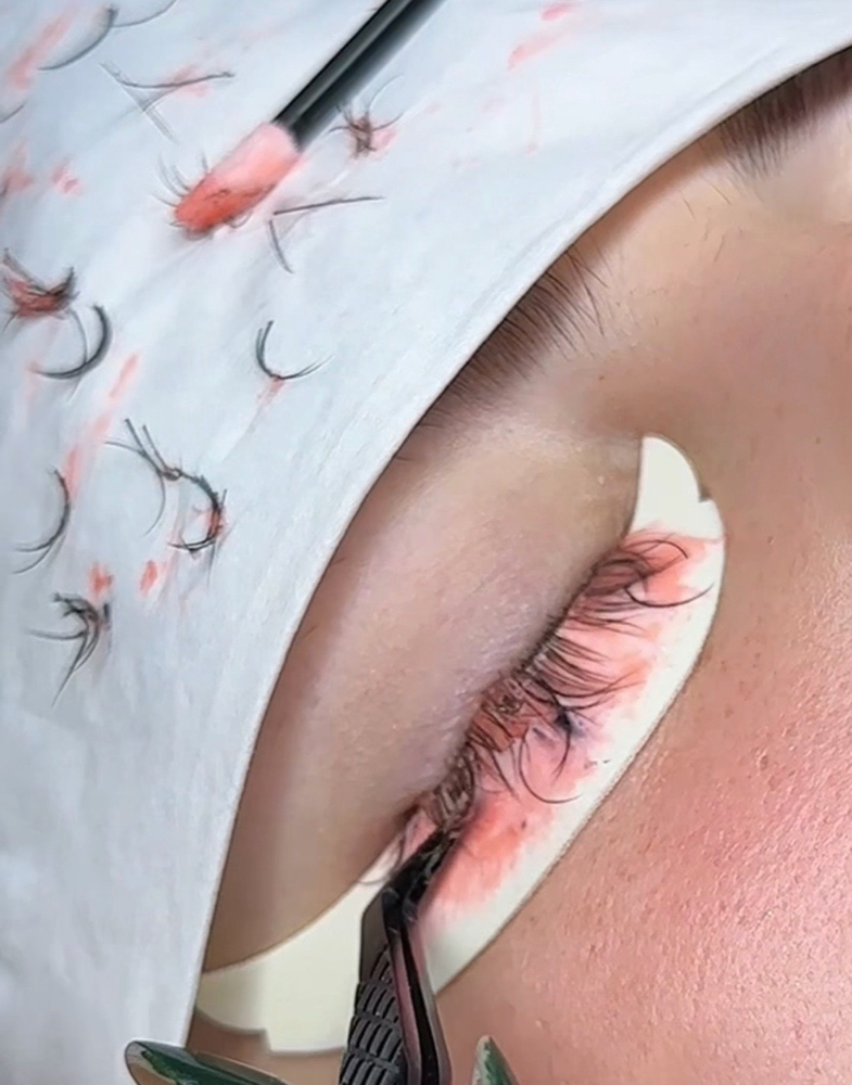 Eʏᴇʟᴀsʜ Exᴛᴇɴsɪᴏɴ Rᴇᴍᴏᴠᴀʟ