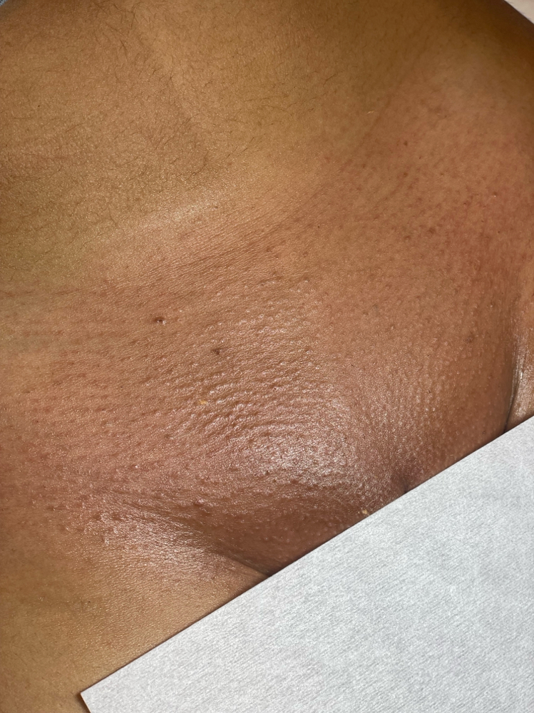 Brazilian Wax at Aestheticbylola in Bronx, NY