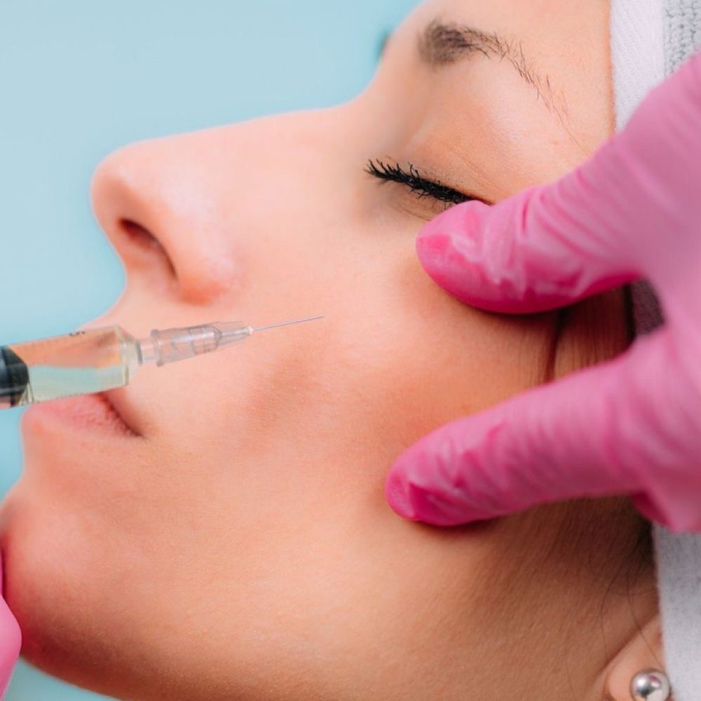 Cheek Filler at Sharon Nicole Aesthetics in Patchogue, NY