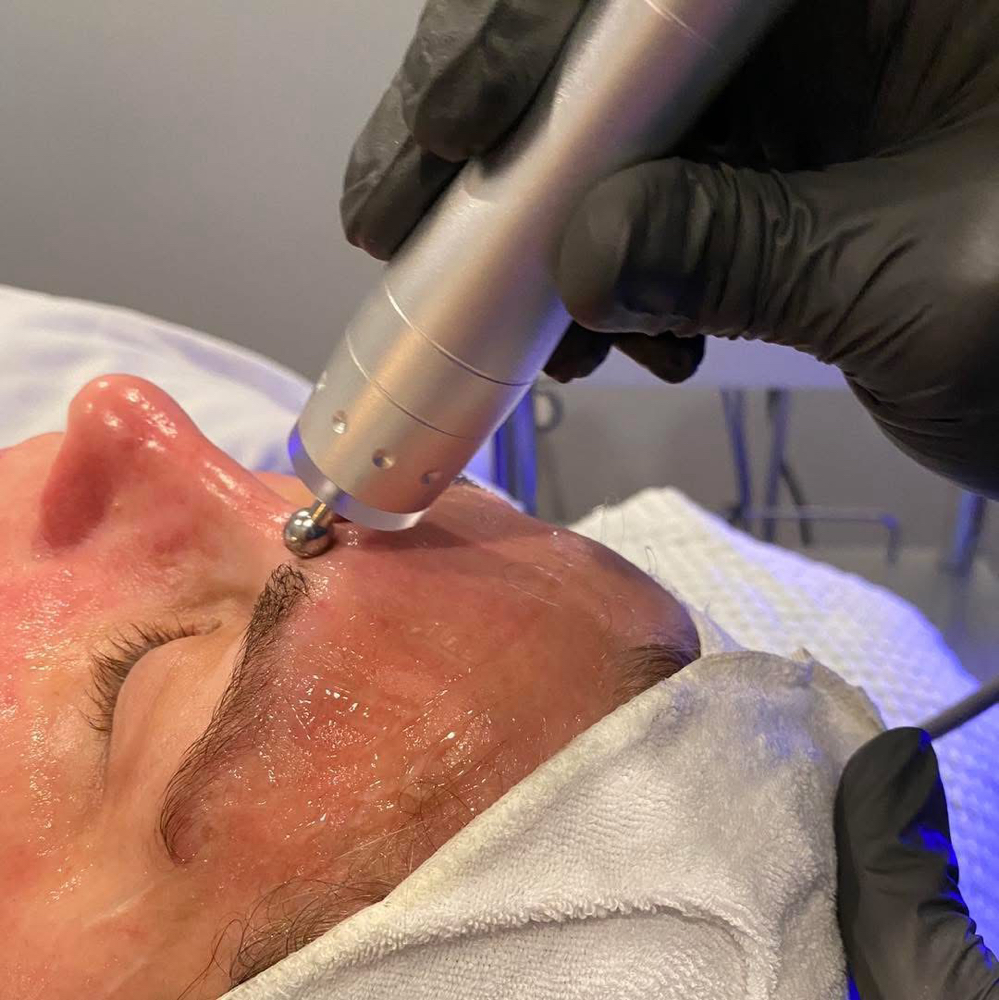 Microcurrent Facial Add On