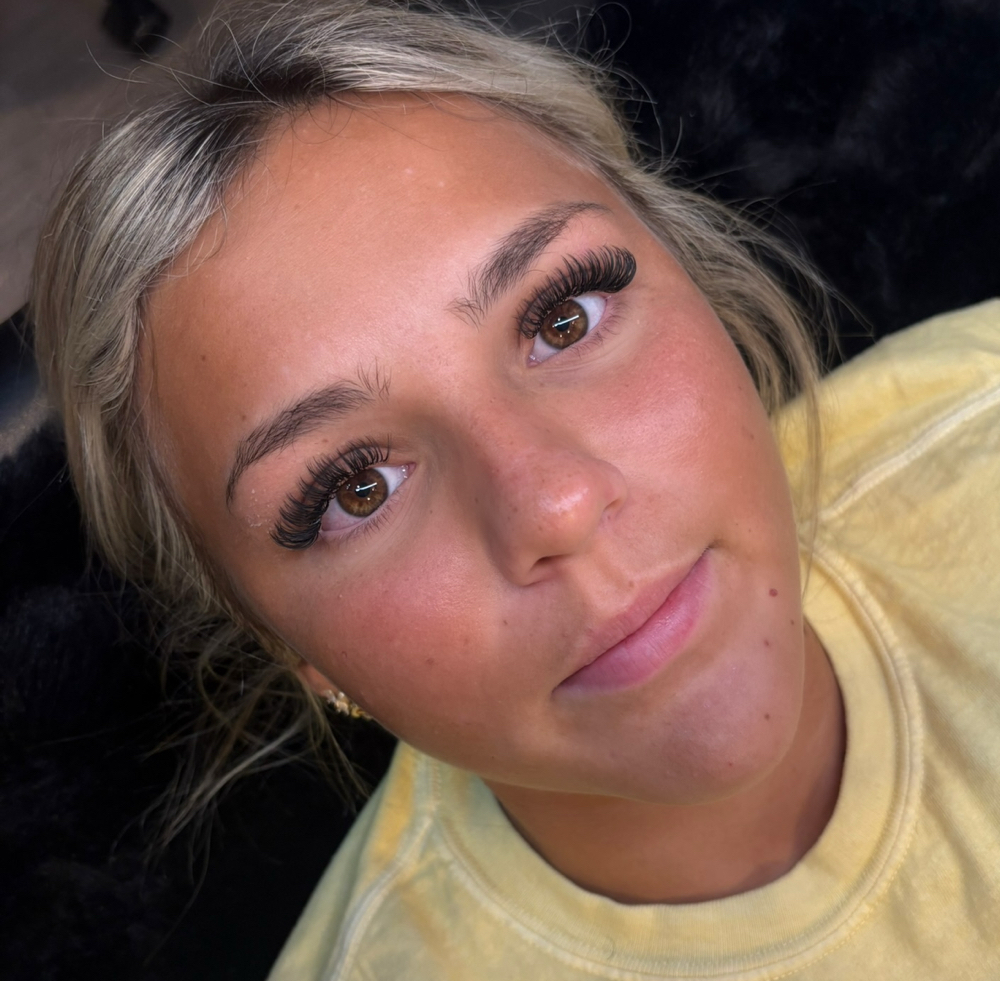 Mini Fill (Within 7 Days)