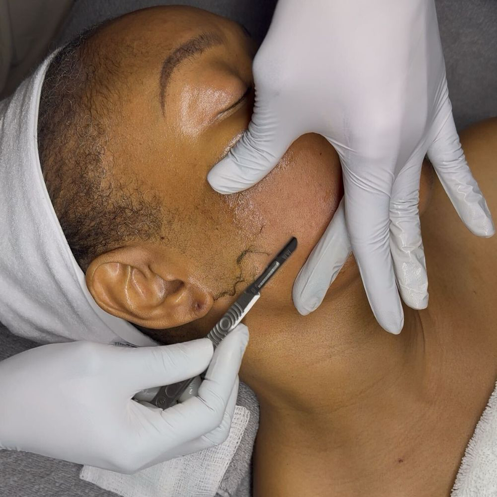 Oil Dermaplane (Only) at BeYou Cosmetics LLC in Columbus, OH