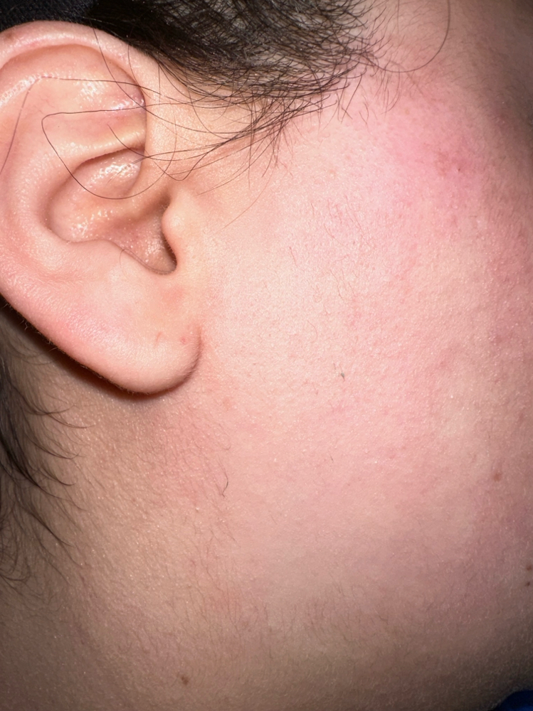 Side Burns/Cheeks Wax
