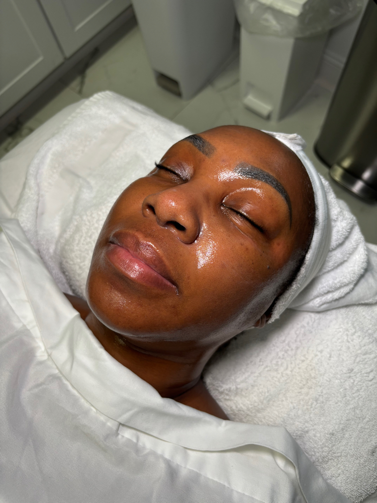 Nano Needling