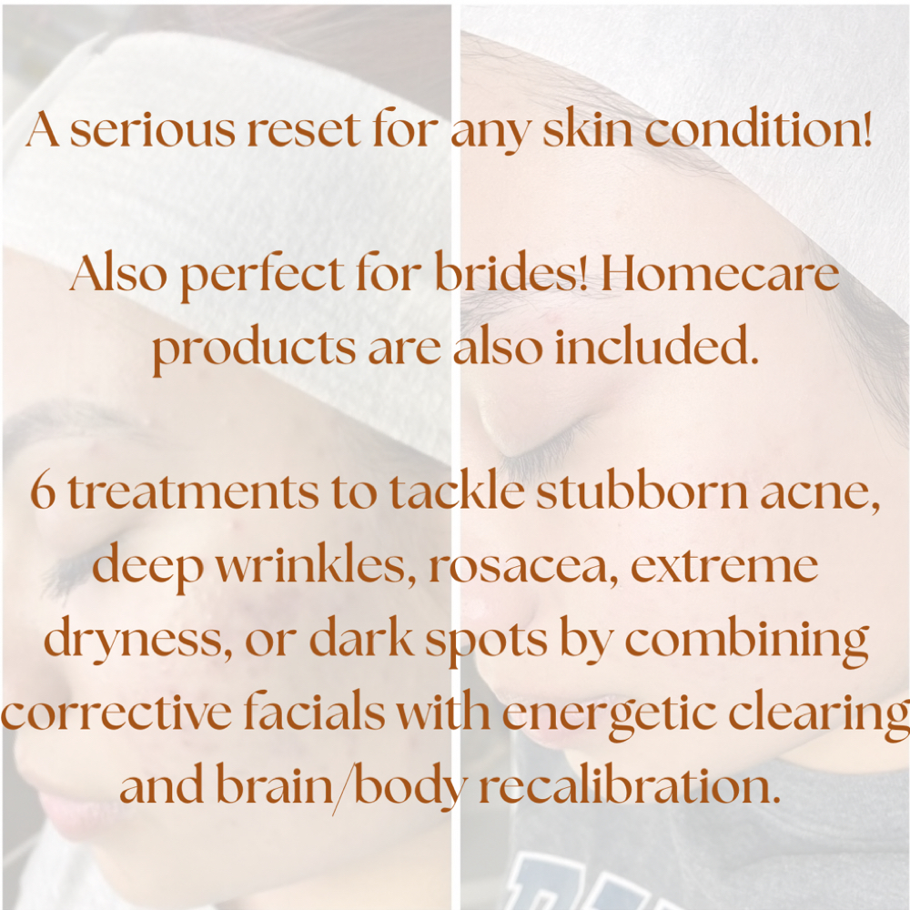 Skin Reset Journey at Elevate Skin + Soul in Scottsdale, AZ