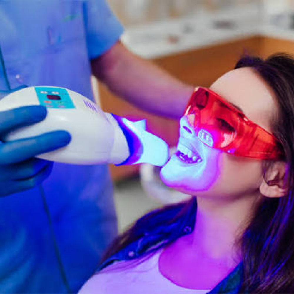 TEETH WHITENING at Irena Studio & Academy in McAllen, TX