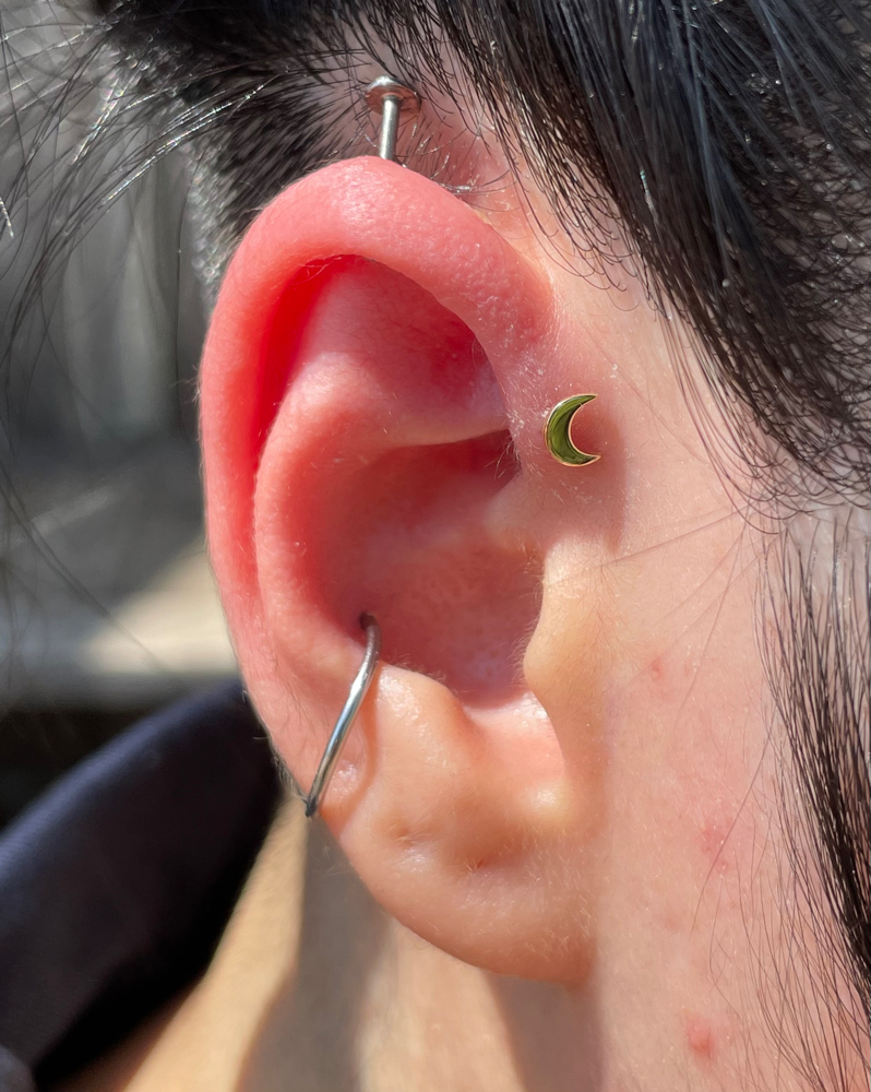 Forward Helix